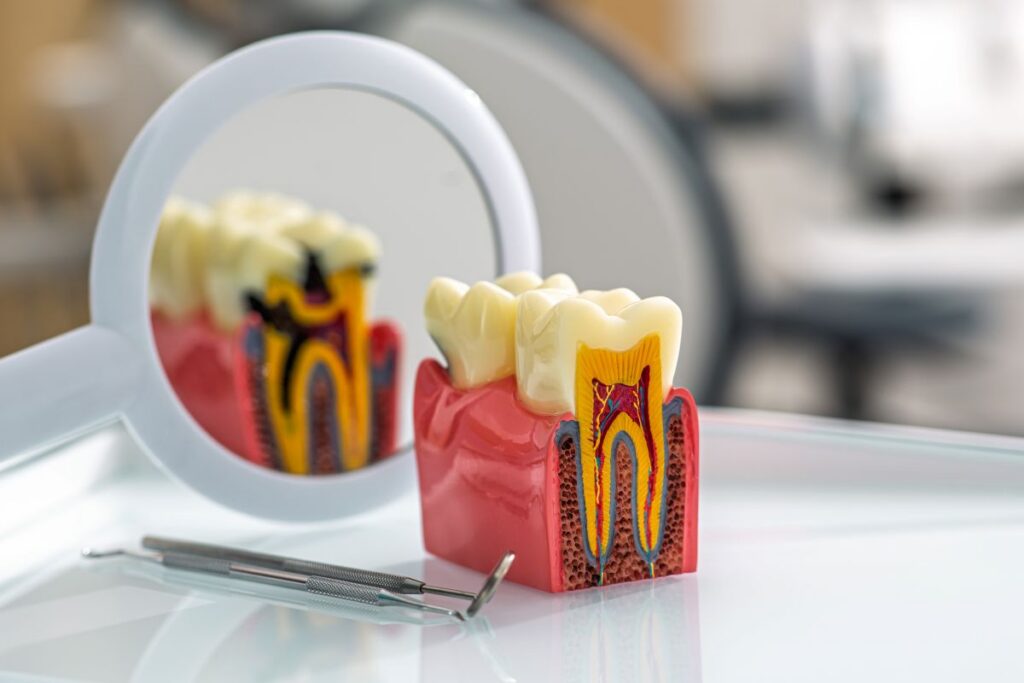 Dental model showing a cross-section of a tooth with a mirror and dental instruments nearby.
