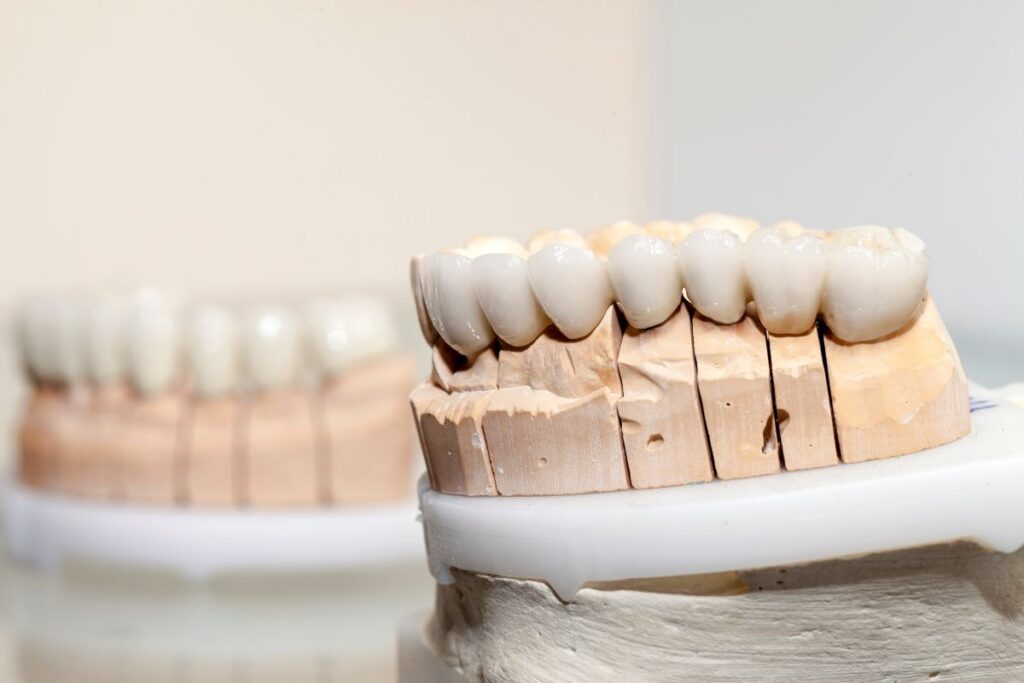 Dental model showing an upper row of artificial teeth on a wooden base for dental prosthetics.