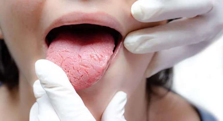 Dental professional examining a patient’s tongue